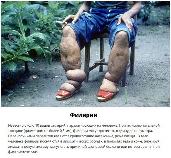 Паразиты, которых следует опасаться летом - ФОТО